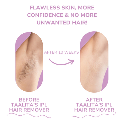 Nullux™ IPL Hair Removal